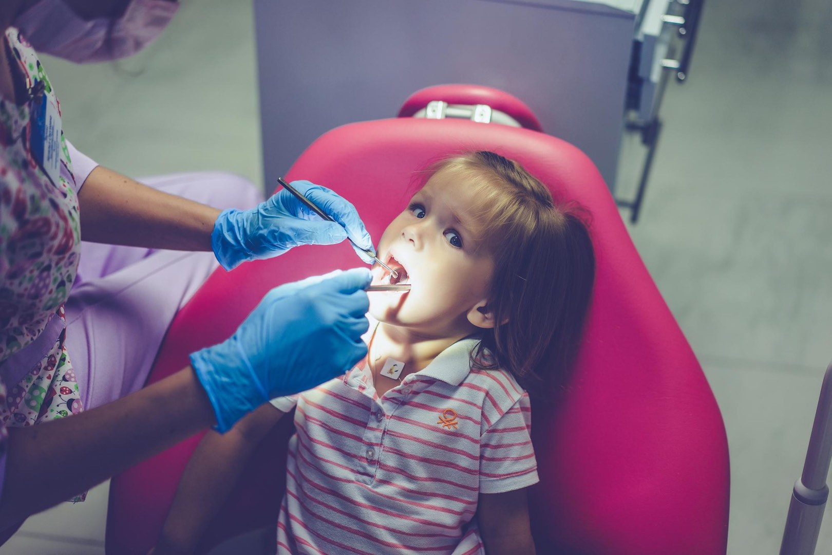 فلوريد ديامين الفضة قد يقضي على تسوس الأسنان لدى الأطفال